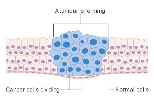 Cancer_Diagram.jpg