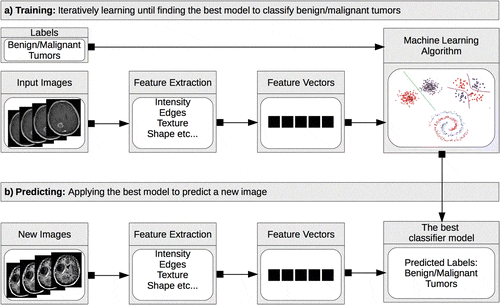 ML_in_Medical_Imaging.gif