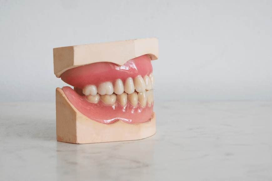 Veneers.png