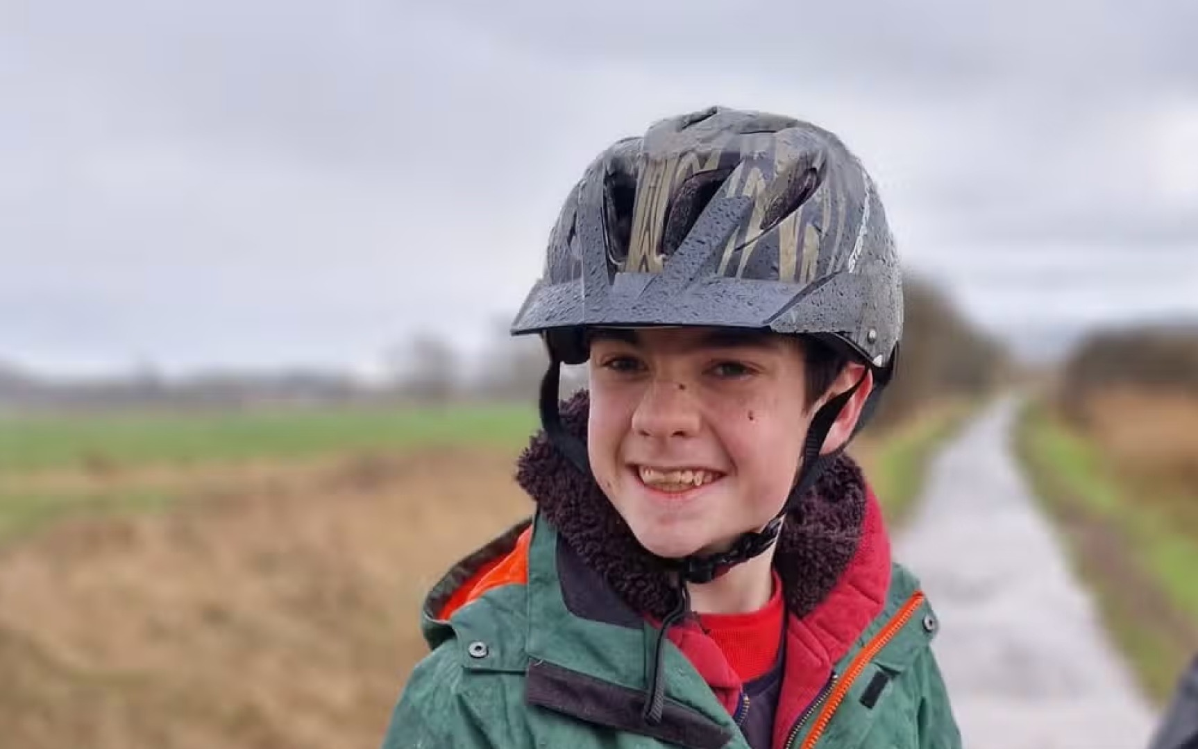 World's First Skull-Embedded Epilepsy Device Transforming Lives: Oran Knowlson's Remarkable Journey